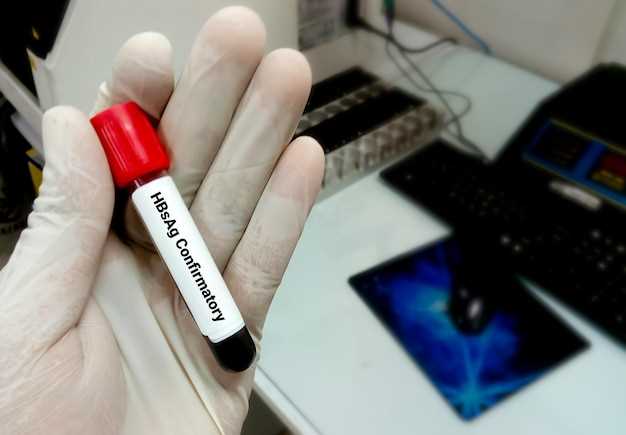 Анализы крови для выявления аутоиммунных заболеваний