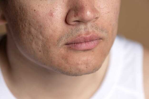Как избавиться от бородавки на лице в домашних условиях?