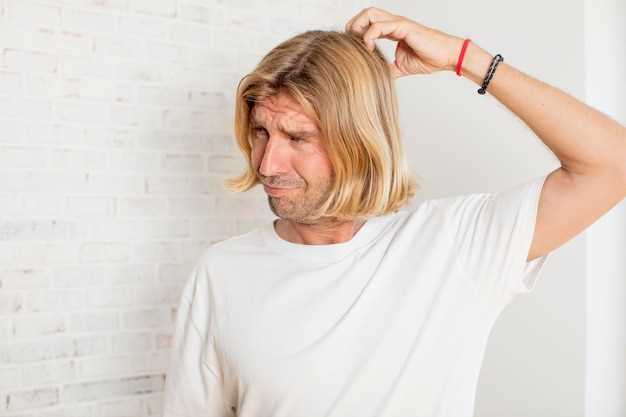 Как прекратить выпадение волос у мужчин?