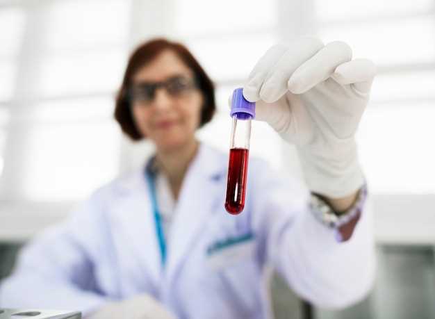Основные правила сдачи анализа на биохимию крови