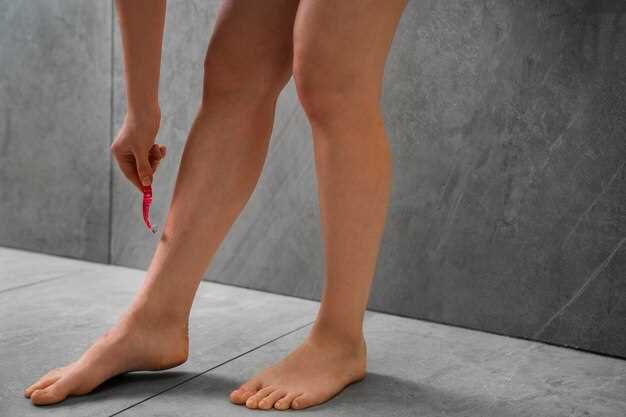 Что такое варикоз вен на ногах