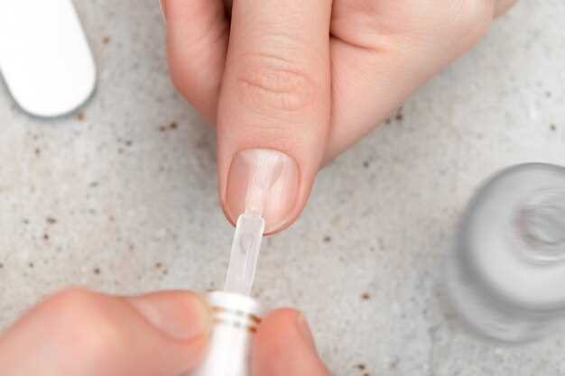 Способы вылечить онихолизис ногтей на руках