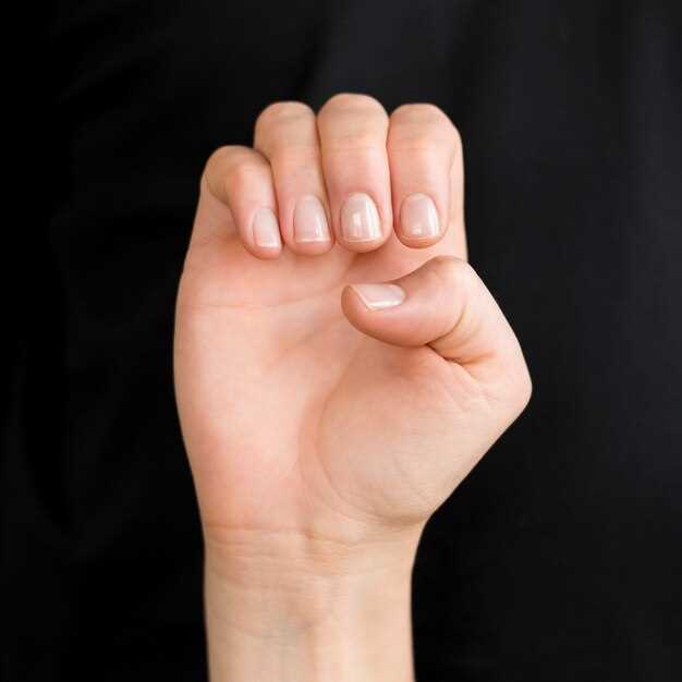Что такое онихолизис ногтей
